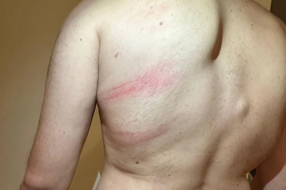 Podgoričanin tvrdi da su ga specijalci brutalno pretukli; UP: Napao ih je